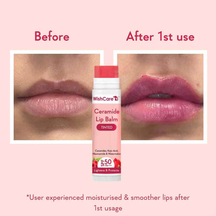 WishCare Ceramide Lip Balm with SPF 50 PA+++ (Tinted)