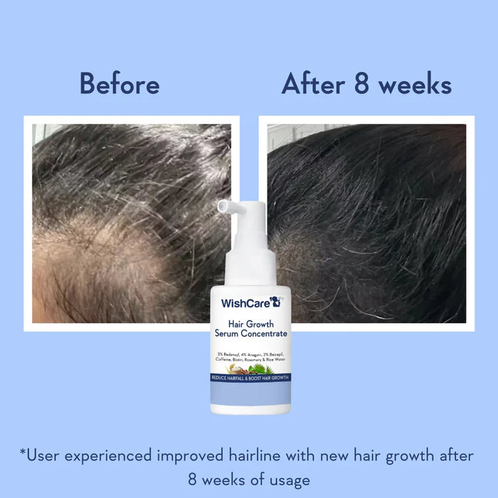 WishCare - Hair Growth Serum Concentrate