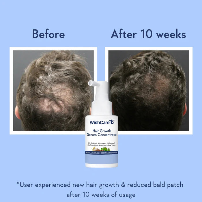 WishCare - Hair Growth Serum Concentrate