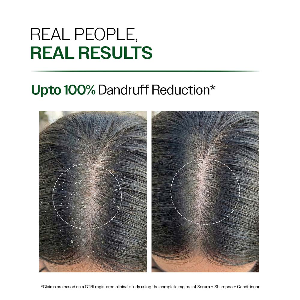 Bare Anatomy - Anti-Dandruff Shampoo with Salicylic Acid & Biotin | 250 ml