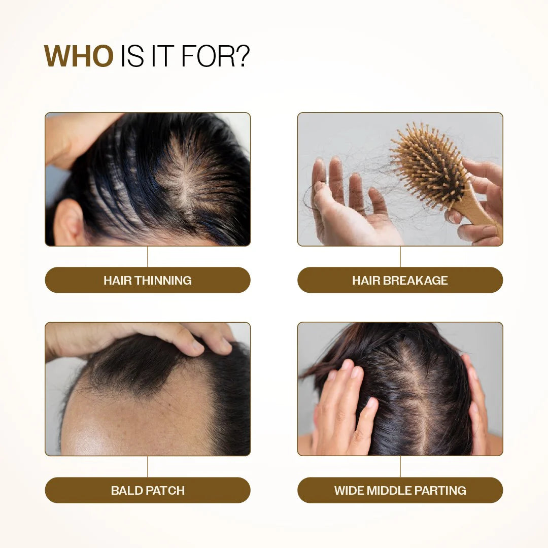 Bare Anatomy - Advanced Hair Growth Serum with Redensyl, Rosemary & Rice Water | 30 ml