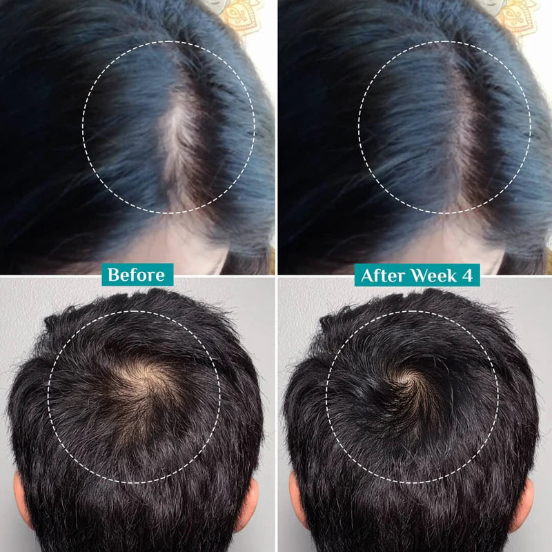 Pilgrim Advanced Hair Growth Serum 2.0