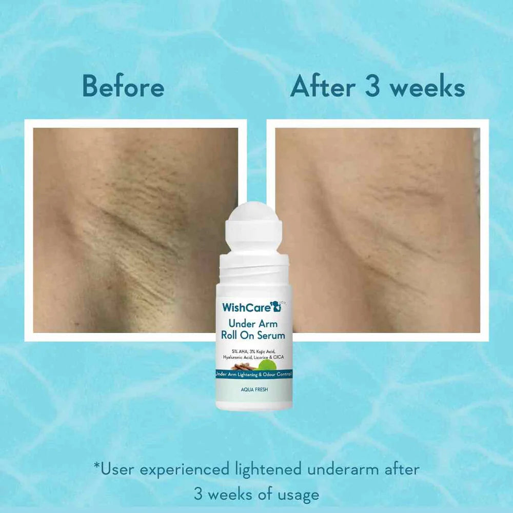 WISHCARE - Under Arm Roll On Serum (50ml)