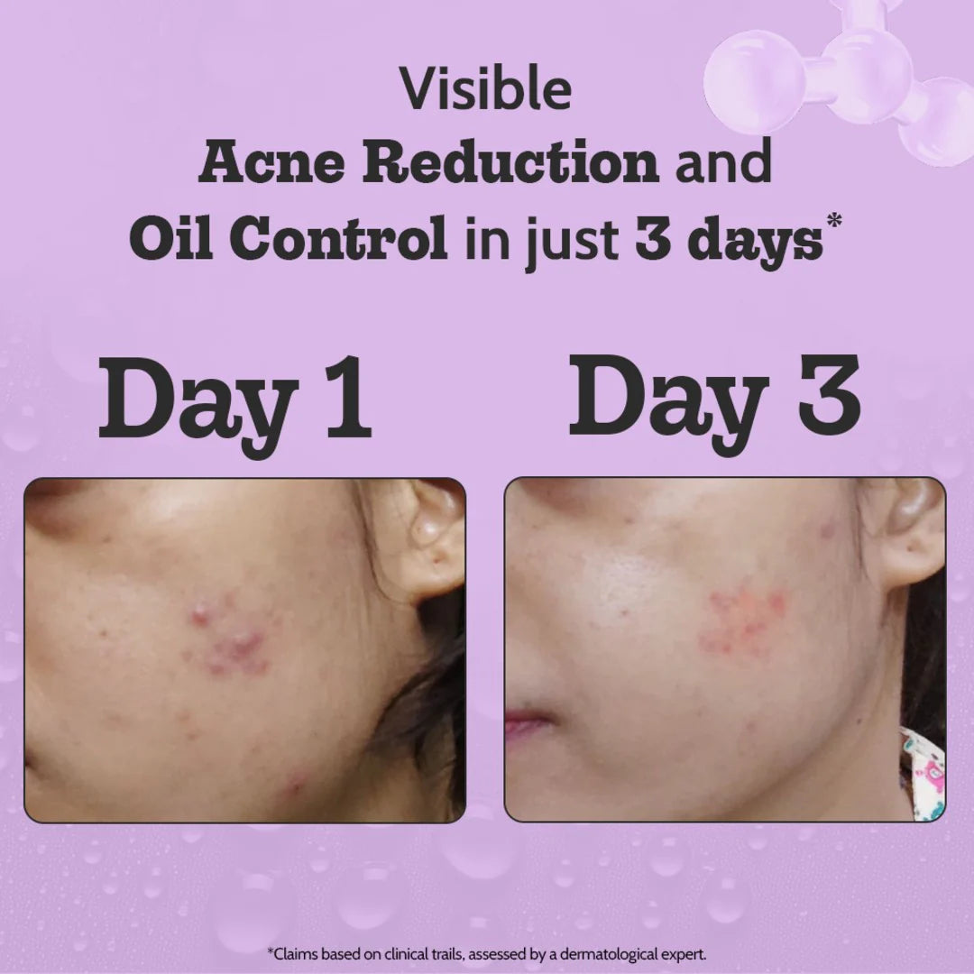 Chemist at Play 2% Salicylic Acid Serum with Lactic Acid & Zinc PCA