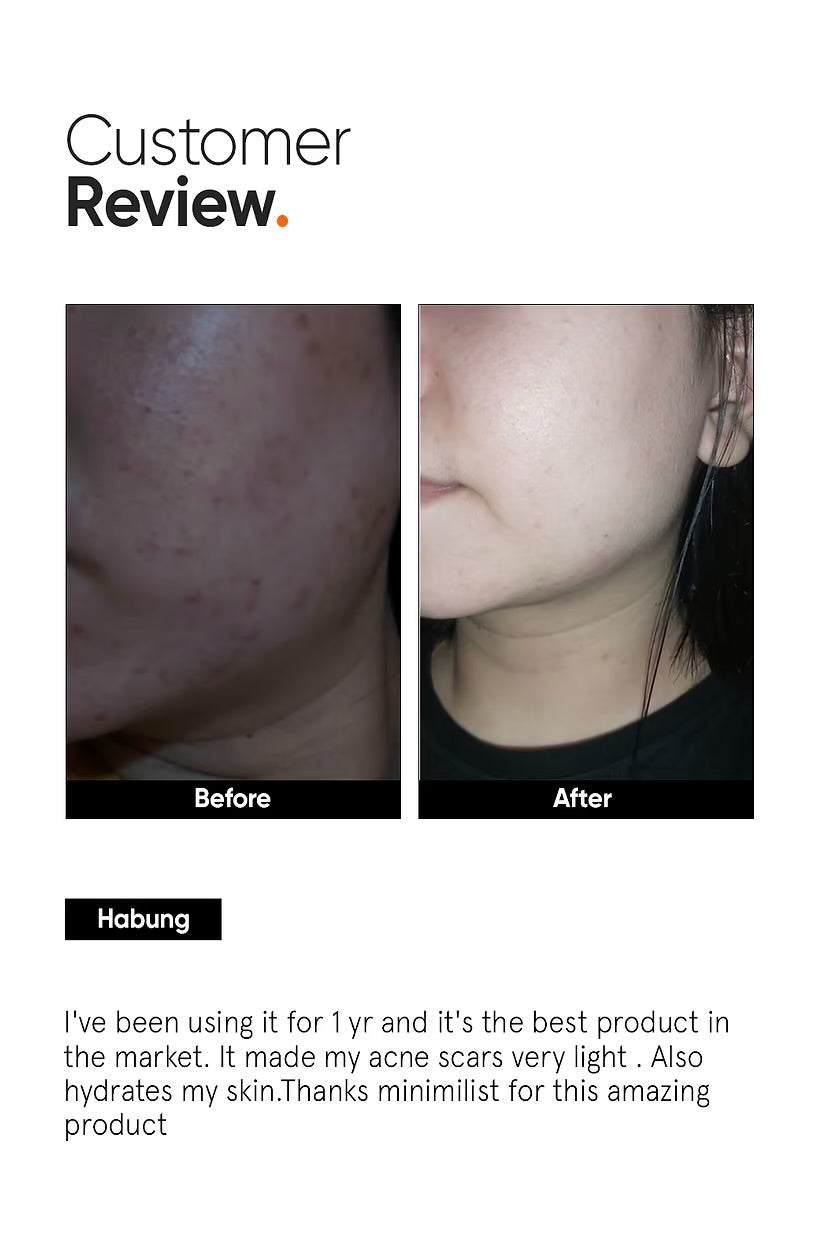 Alpha Arbutin 2% Face Serum