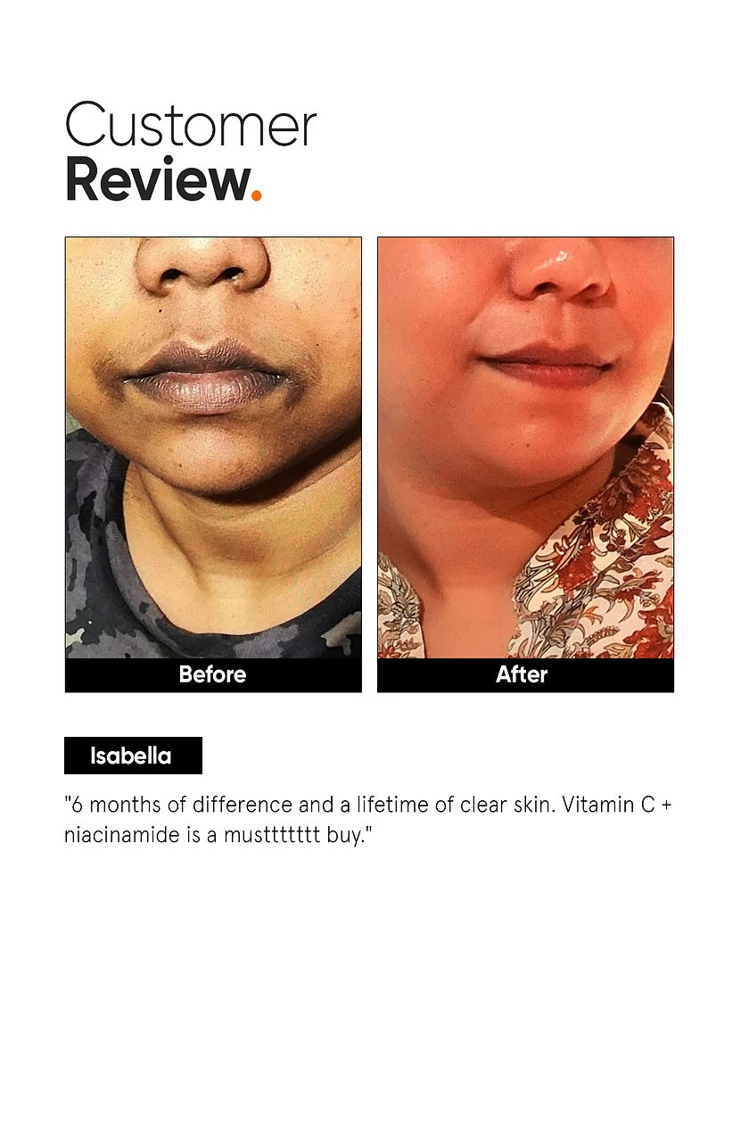 Vitamin C + E + Ferulic 16% Face Serum