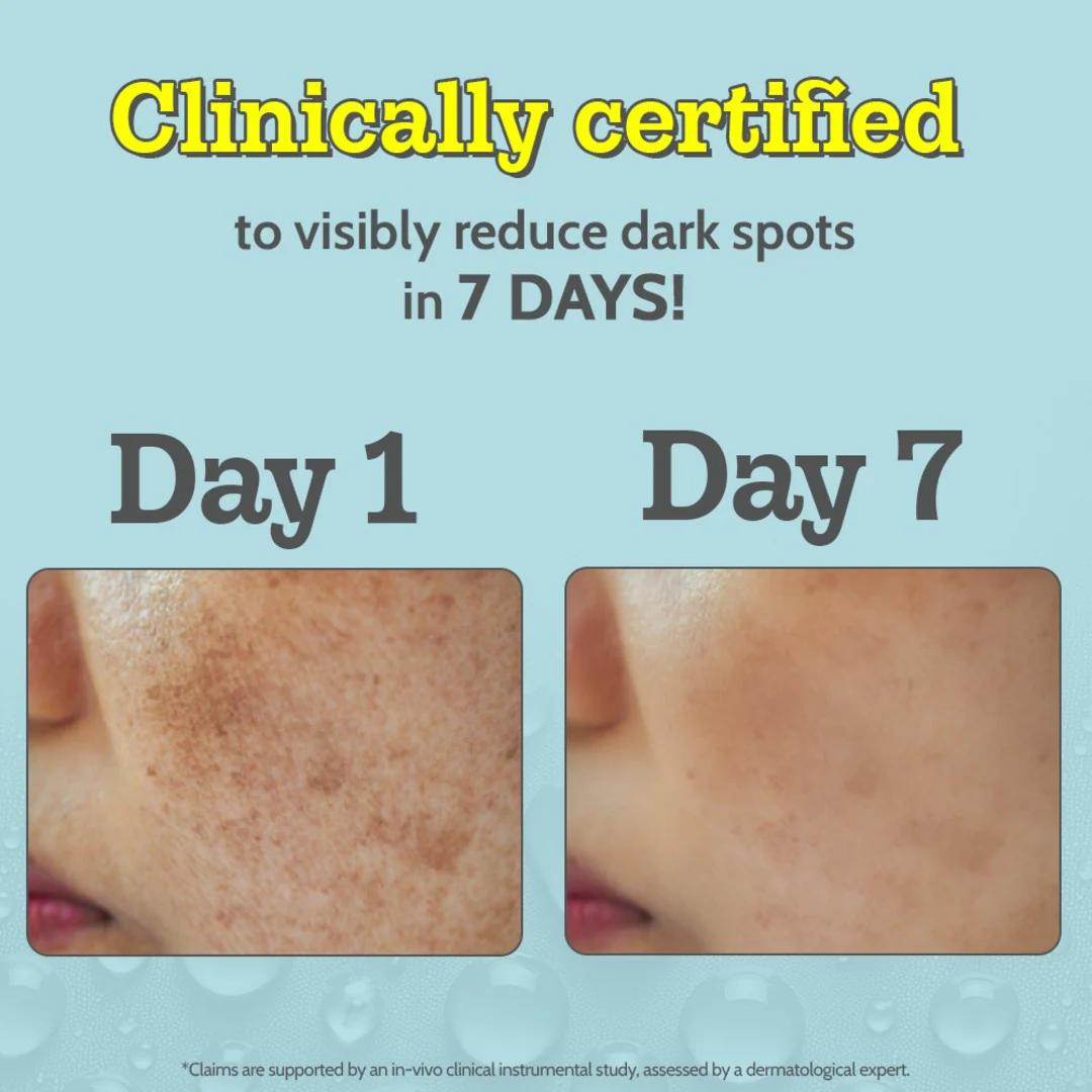 10% Vitamin C Face Serum for Glowing & Bright Skin