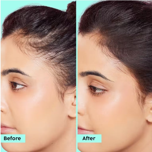 PLIX - Rosemary Hair Growth Advanced Hair Spray