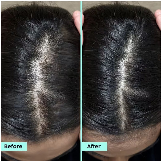 PLIX - Rosemary Hair Growth Advanced Hair Spray