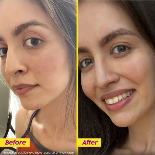 PLIX - Pineapple De-Pigmentation Dewy Serum - 30ml