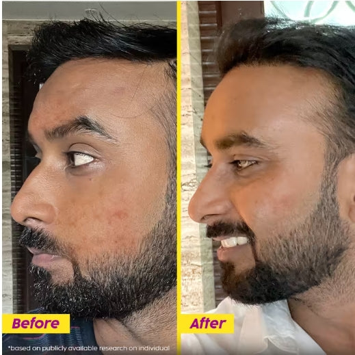 PLIX - Pineapple De-Pigmentation Dewy Serum - 30ml