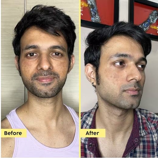 PLIX - Pineapple De-Pigmentation Juicy Cleanser