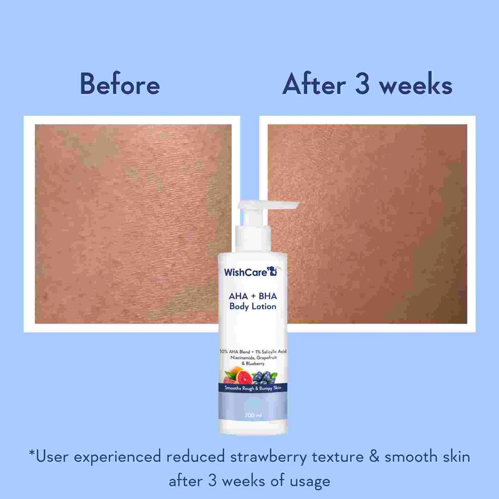 WISHCARE - AHA + BHA Body Lotion (200ML)