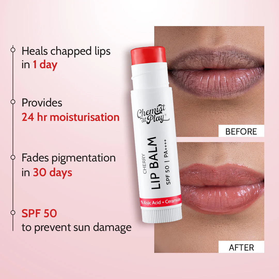 Chemist at Play - Cherry Lip Balm for Chapped & Pigmented Lips | SPF 50 PA++++ & Kojic Acid