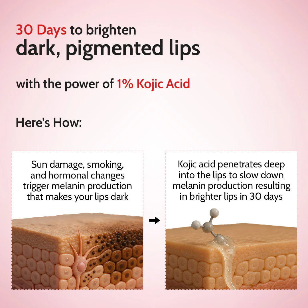 Chemist at Play - Cherry Lip Balm for Chapped & Pigmented Lips | SPF 50 PA++++ & Kojic Acid