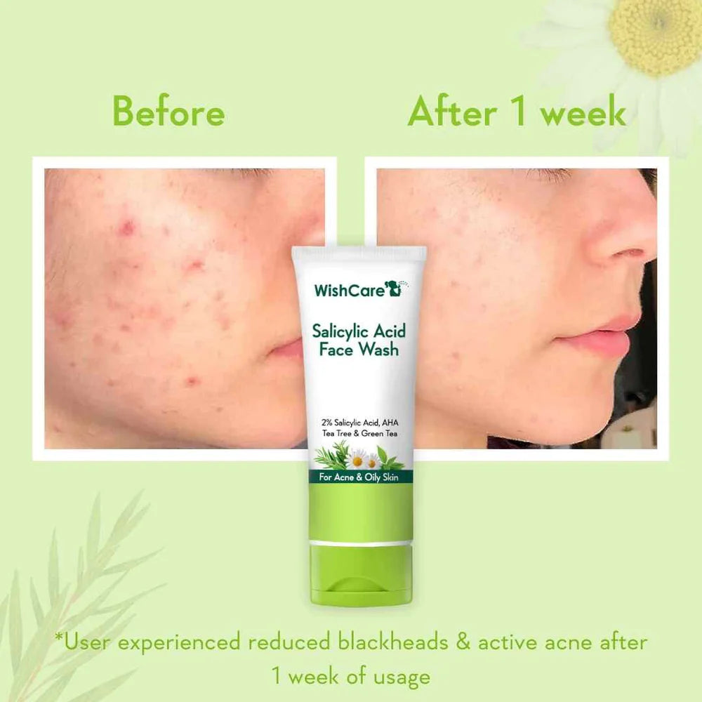 WishCare - 2% Salicylic Acid Face Wash