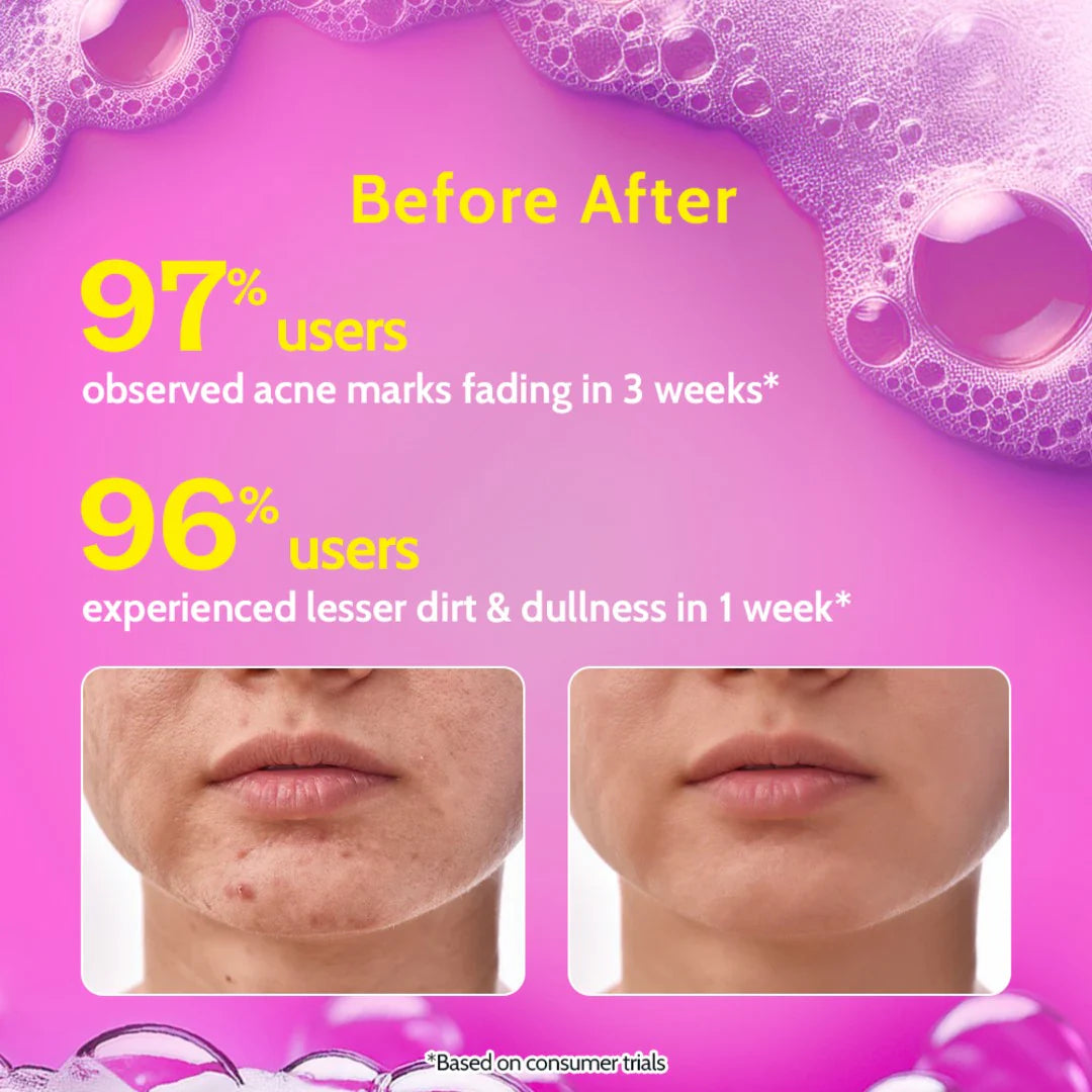 Chemist at Play - Salicylic Acid Face Wash for Acne & Oil Control- 100ml